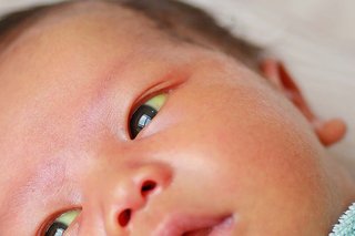 Newborn baby’s face. The skin and the whites of the eyes look yellow.